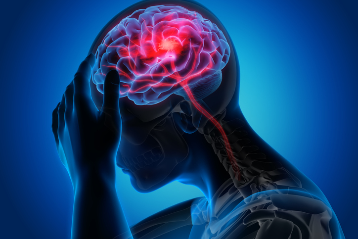 Emicrania: riconoscere la malattia cronica e anticipare cure innovative, il confronto degli esperti 1 Emicrania: disabilità e impatto nella vita quotidiana
