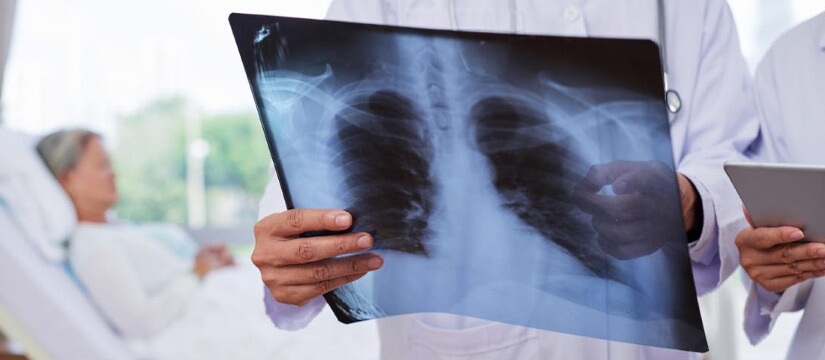 Salute respiratoria e visita pneumologica: quando e perchè effettuarla 1 A cosa serve la visita pneumologica?
