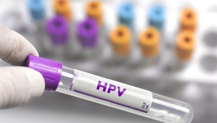 Vaccinazione contro il Papilloma Virus: la Puglia fa un passo avanti nella tutela degli adolescenti. Anche altre Regioni dovrebbero adeguarsi 1 Screening Diagnostici e Peculiarità degli Esami e Check-up per prevenire e identificare papilloma virus