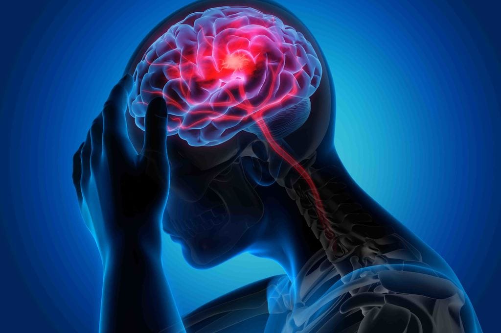 Il gemello digitale che anticipa l’ictus: l’Europa accelera con l’intelligenza artificiale 1 Prevenzione attiva: il ruolo degli stili di vita per prevenire l'ictus