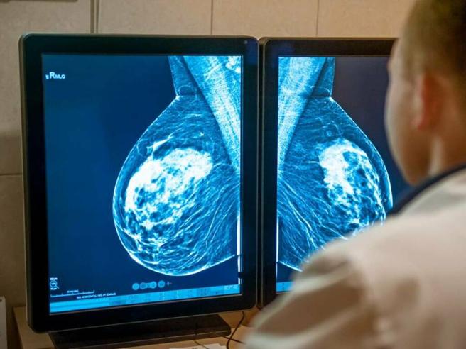 Tumore al seno: ecco il nuovo farmaco che rallenta la diffusione 1 L’importanza dei controlli periodici nella battaglia contro il tumore al seno