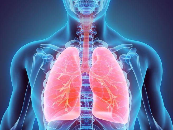 Arriva una svolta farmacologica nella cura delle bronchiectasie 1 Come si sviluppano le bronchiectasie