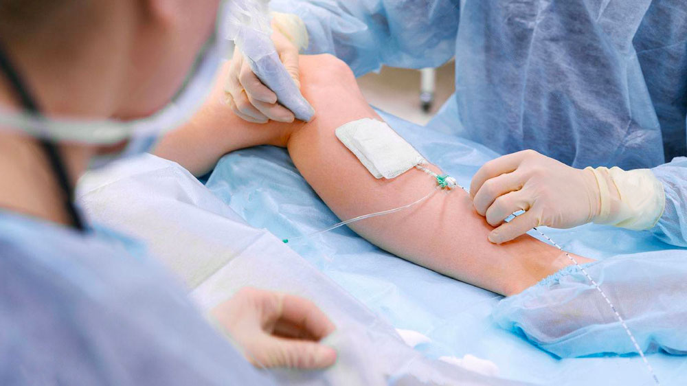 Quando la chirurgia vascolare diventa davvero necessaria 1 Chirurgia vascolare: tecniche sempre meno invasive