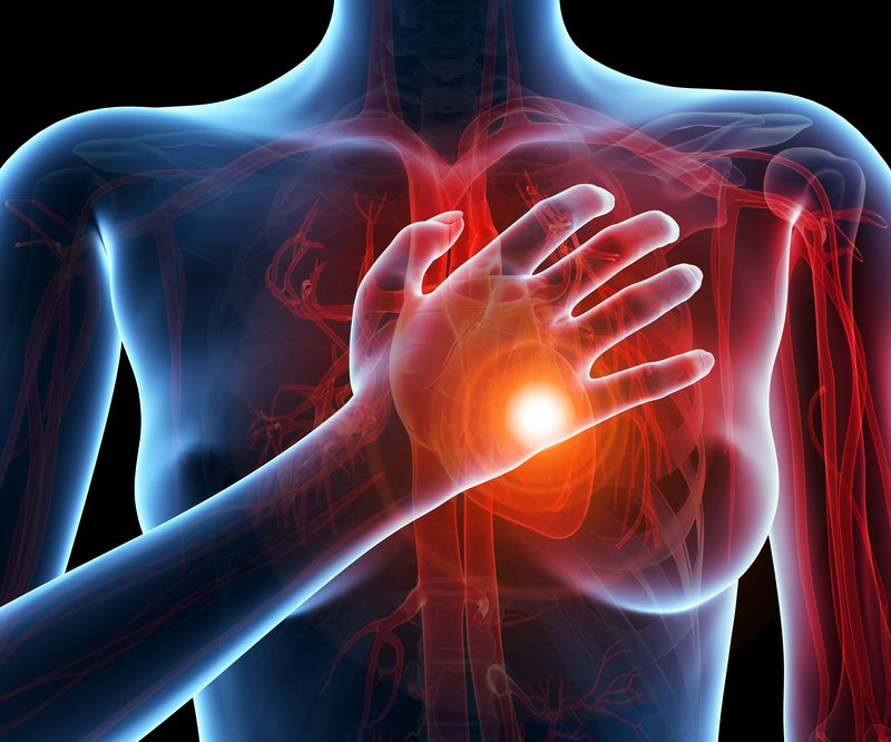 Malattie cardiovascolari, colesterolo Ldl sotto controllo. Il progetto Bring-Up cambia la prevenzione cardiovascolare 1 Bring-Up: un intervento nazionale su larga scala per le malattie cardiovascolari