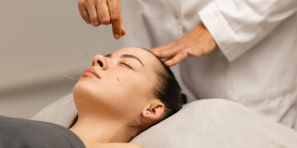 Agopuntura e neuroscienze: oltre 2 milioni di italiani scelgono la neuro-agopuntura 1 Origini e diffusione della neuro agopuntura
