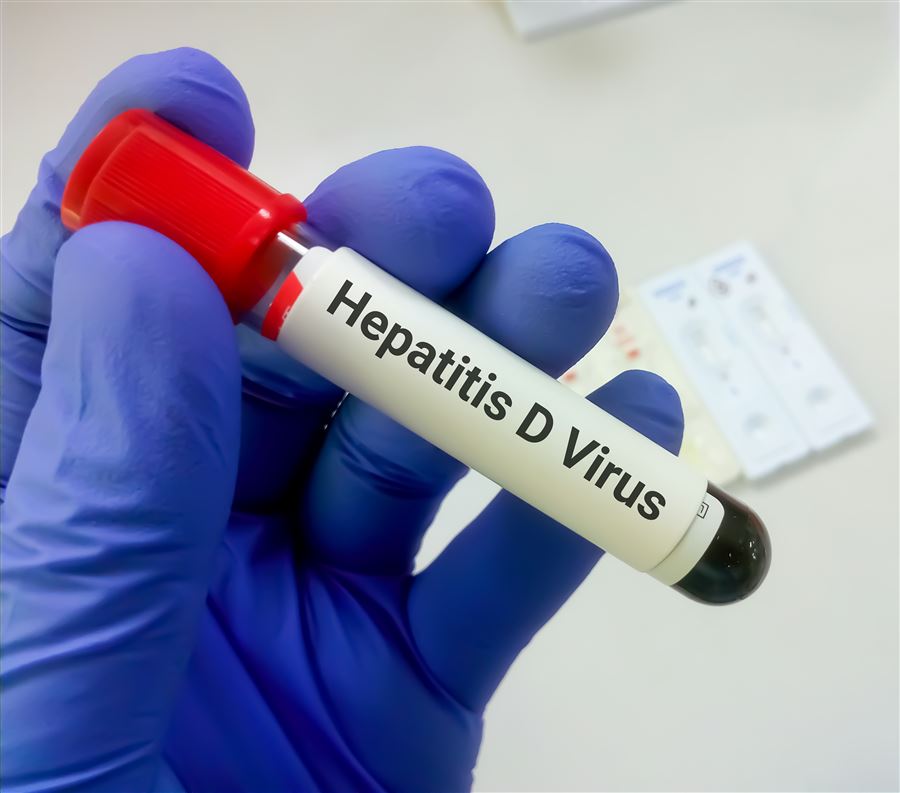 Allarme Oms: nuovi virus inseriti tra gli agenti che causano tumori. Al primo posto ci sono i rischi al fegato 1 Visite specialistiche mirate e prevenzione efficace contro il rischio di tumori