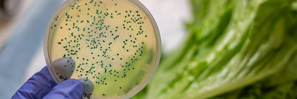 Cibo contaminato: ogni giorno oltre un milione e mezzo di persone nel mondo si ammalano 1 Cibo contaminato: visite specialistiche mirate e prevenzione alimentare