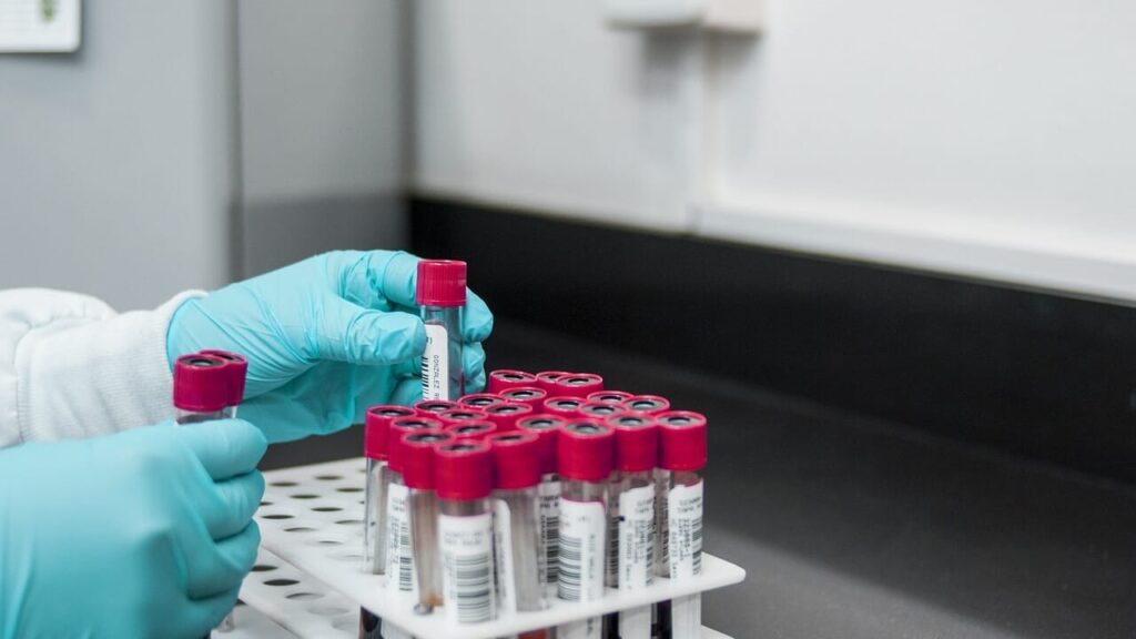Visite specialistiche mirate e prevenzione tempestiva per curare i tumori del sangue