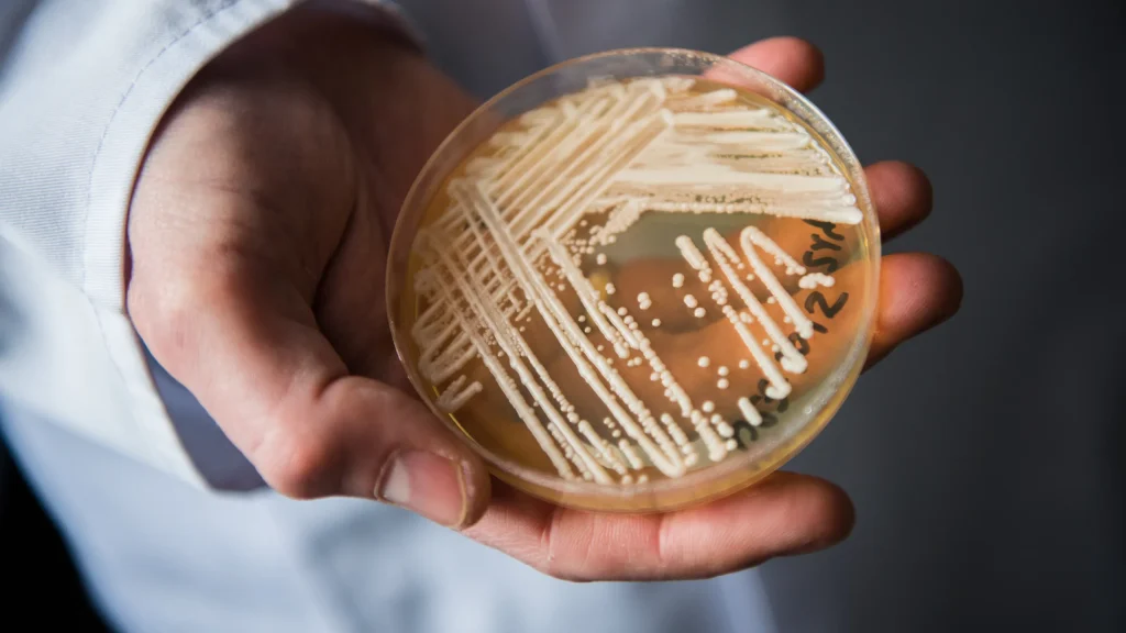 Candida auris, Italia al terzo posto in Europa: sintomi e rischi del “fungo killer” 1 Candida auris: sintomi da non sottovalutare