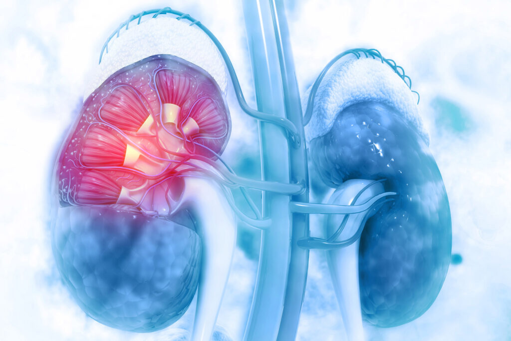 Malattia renale cronica, la dieta a basso contenuto proteico può ridurre i costi e migliorare la vita dei pazienti 1 Malattia renale cronica: sfida di sistema per la sanità pubblica