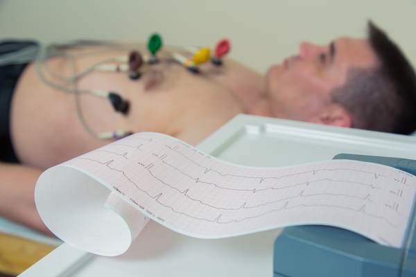 Miocardite silente nei giovani: una minaccia invisibile per il cuore 1 elettrocardiogramma
