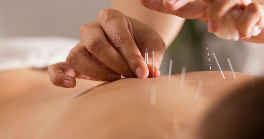 L’agopuntura può essere utile anche in ambito endocrinologico?