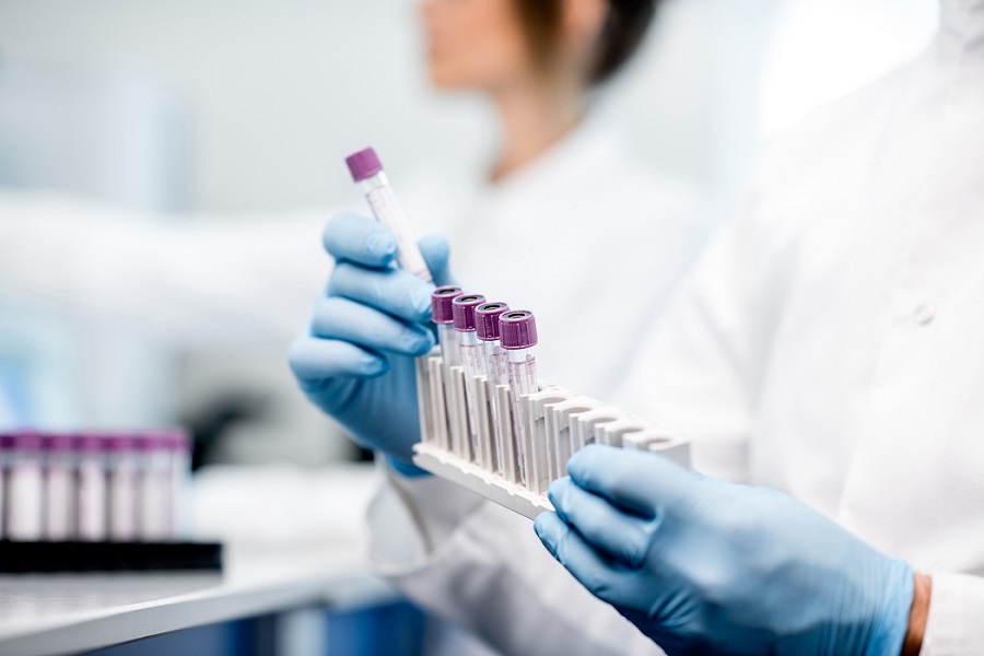 Analisi di laboratorio