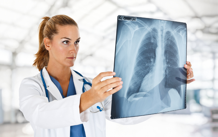 Dispnea e fiato corto: come riconoscere i segnali e quando intervenire davvero 1 Visite specialistiche e prevenzione per diagnosticare la dispnea