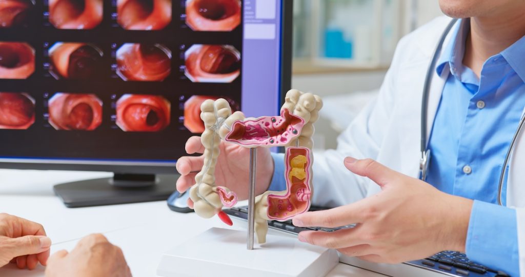 Il tumore del colon-retto sta aumentando tra i giovani: perché anticipare lo screening può davvero salvare la vita 1 Visite specialistiche e prevenzione mirata: tumore del colon-retto nemico numero uno