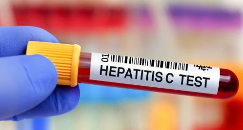 Epatite C, screening e cure: l’Italia accelera verso il traguardo 2030 1 Epatite C: visite specialistiche e prevenzione