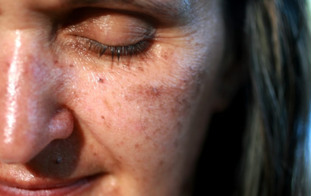Visite specialistiche e trattamenti dermatologici mirati