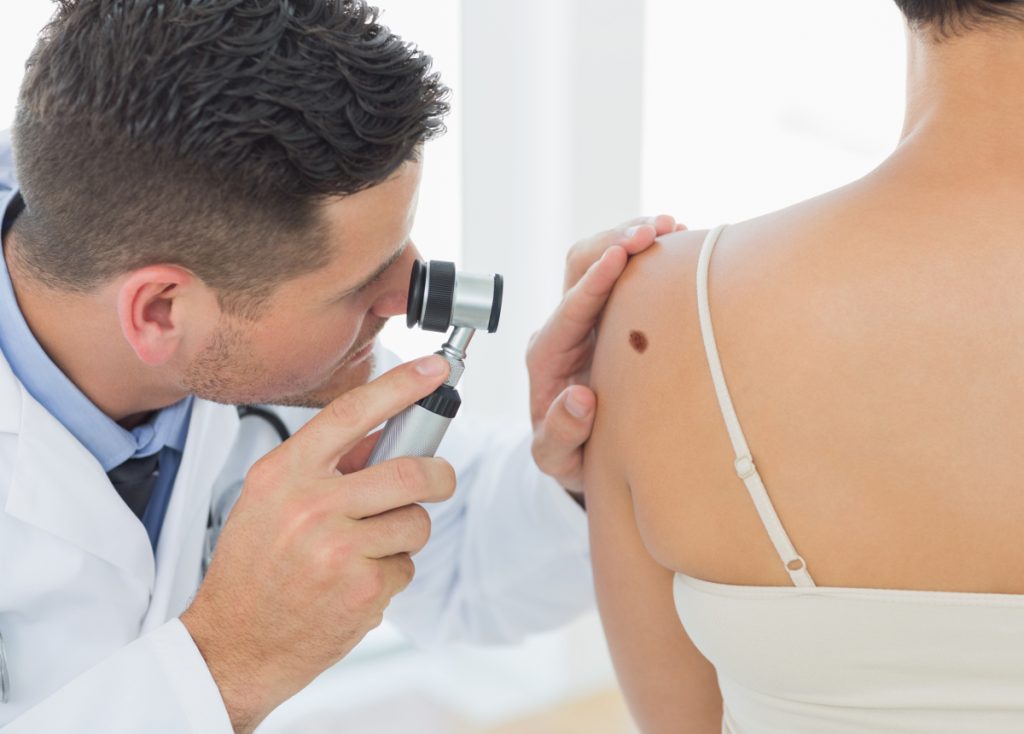 Visite specialistiche e prevenzione dermatologica: come accorgersi in tempo della presenza di una melanoma
