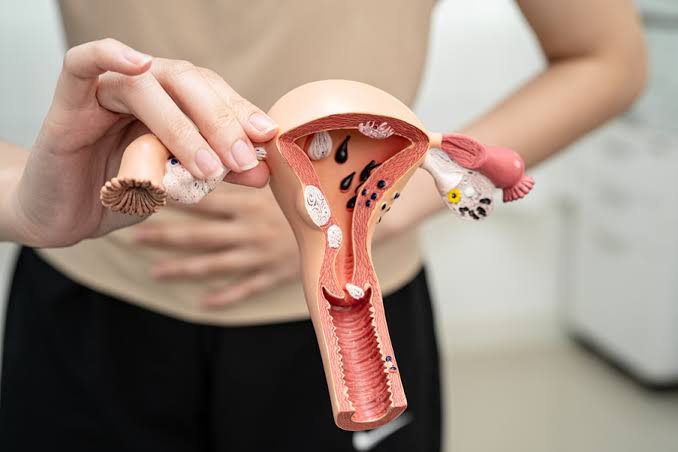 Tumore ovarico, prevenzione dalle tube: rischio della forma sierosa ridotto fino al 78% 1 images 1 1