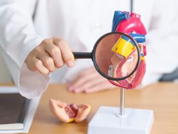 Aterosclerosi e Arteriosclerosi