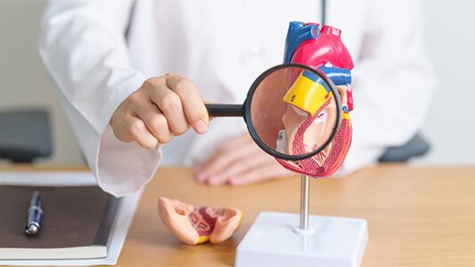 Aterosclerosi e Arteriosclerosi