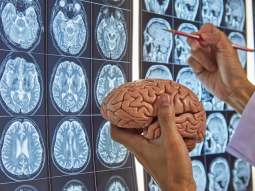 Cervello-si-rigenera-da-adulto-neuroni Cervello si rigenera da adulto neuroni