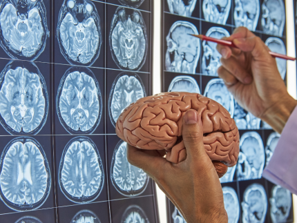 Cervello-si-rigenera-da-adulto-neuroni ?brizy media=34126&brizy crop=iW%3D440%26iH%3D248%26oX%3D54%26oY%3D0%26cW%3D331%26cH%3D248