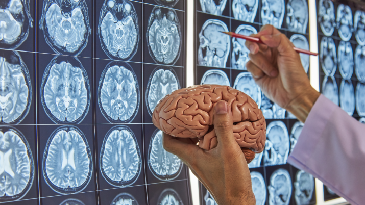 Cervello si rigenera da adulto neuroni