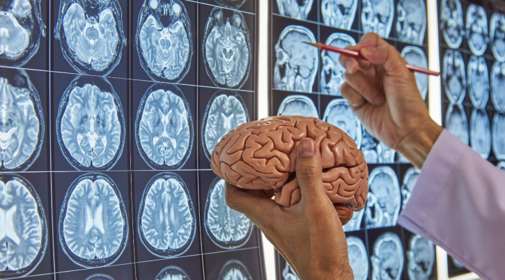 Cervello si rigenera da adulto neuroni