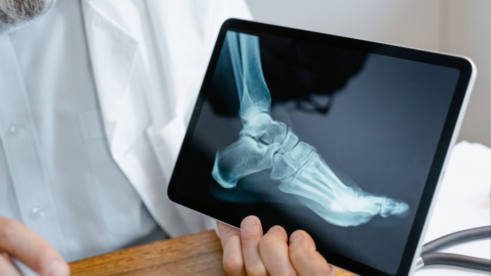 IRM Radiologia Digitale