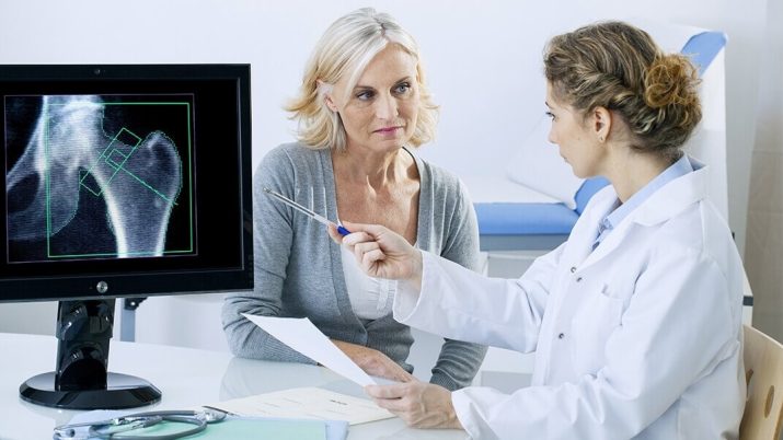 Menopausa e osteoporosi 1
