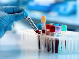 Bagno al mare o in piscina dopo i pasti nei bambini: mito o rischio reale? 19 {{brizy_dc_image_alt entityId=