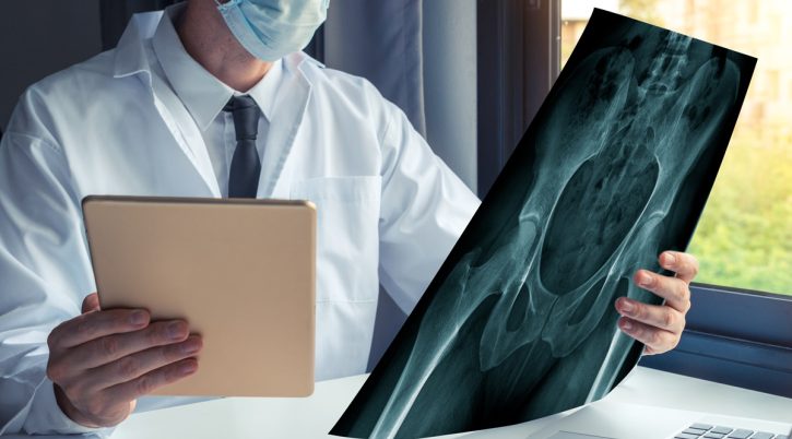 Doctor watching a x-ray of bones of hips and holding a digital tablet anca medico