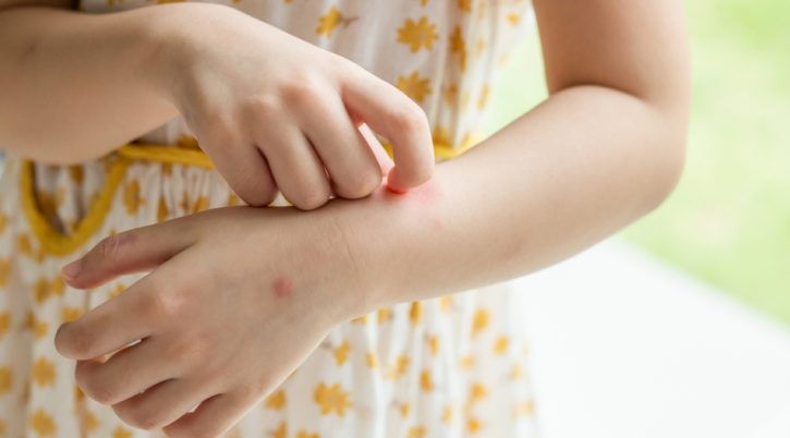 Little girl has skin rash allergy itching and scratching on her arm antizanzare bambini 950x545 1