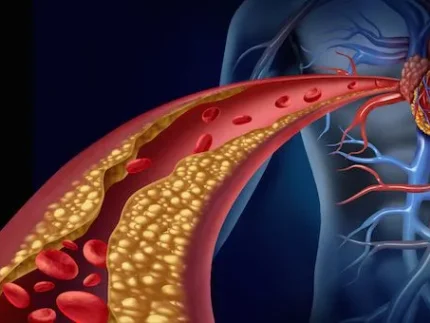 colesterolo-LDL ?brizy media=35199&brizy crop=iW%3D474%26iH%3D248%26oX%3D71%26oY%3D0%26cW%3D331%26cH%3D248