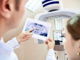 dentalscan come funziona