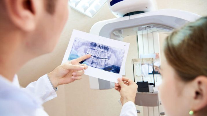dentalscan come funziona