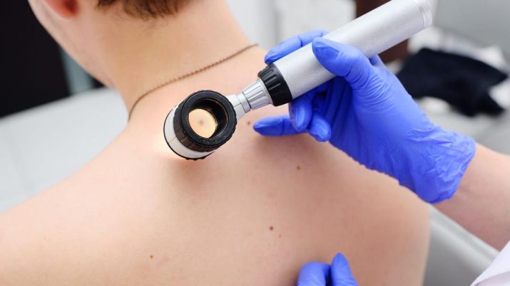 dermatologia