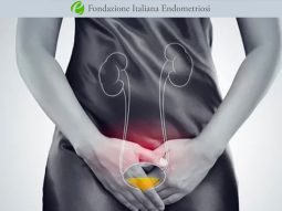 endometriosi-vescicale endometriosi vescicale