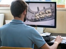 flusso di lavoro digitale odontoiatrico