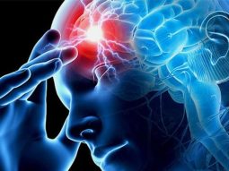 ictus clinica elche neuronova 1