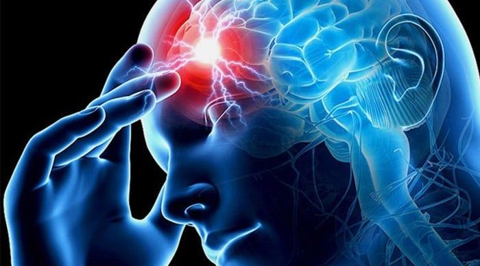 ictus-clinica-elche-neuronova-1 ictus clinica elche neuronova 1