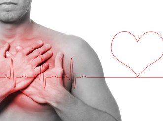 infarto-1030x687 infarto 1030x687 1