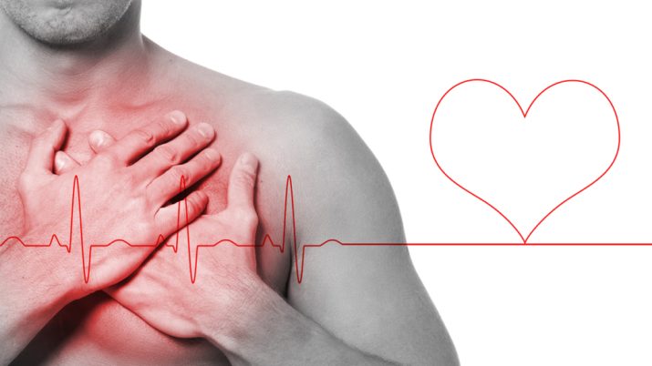 infarto 1030x687 1
