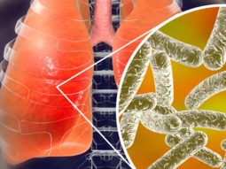 legionella-q2tmdj4jnjads1yl36w7cvjpnxadl4pjd200voh214 legionella q2tmdj4jnjads1yl36w7cvjpnxadl4pjd200voh214