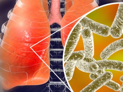 legionella-q2tmdj4jnjads1yl36w7cvjpnxadl4pjd200voh214 ?brizy media=32851&brizy crop=iW%3D565%26iH%3D248%26oX%3D116%26oY%3D0%26cW%3D331%26cH%3D248