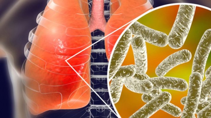 legionella q2tmdj4jnjads1yl36w7cvjpnxadl4pjd200voh214