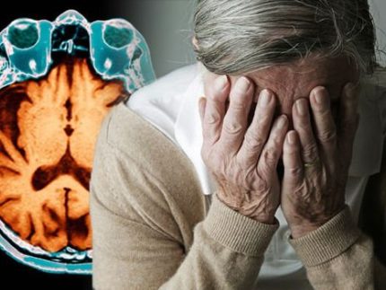 malattia-di-Alzheimer ?brizy media=34469&brizy crop=iW%3D418%26iH%3D248%26oX%3D43%26oY%3D0%26cW%3D331%26cH%3D248