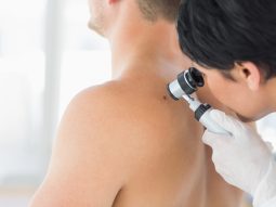 Doctor examining mole on back of man melanoma