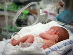 PREMATURE-NEONATALOGIE neonato pretermine scaled